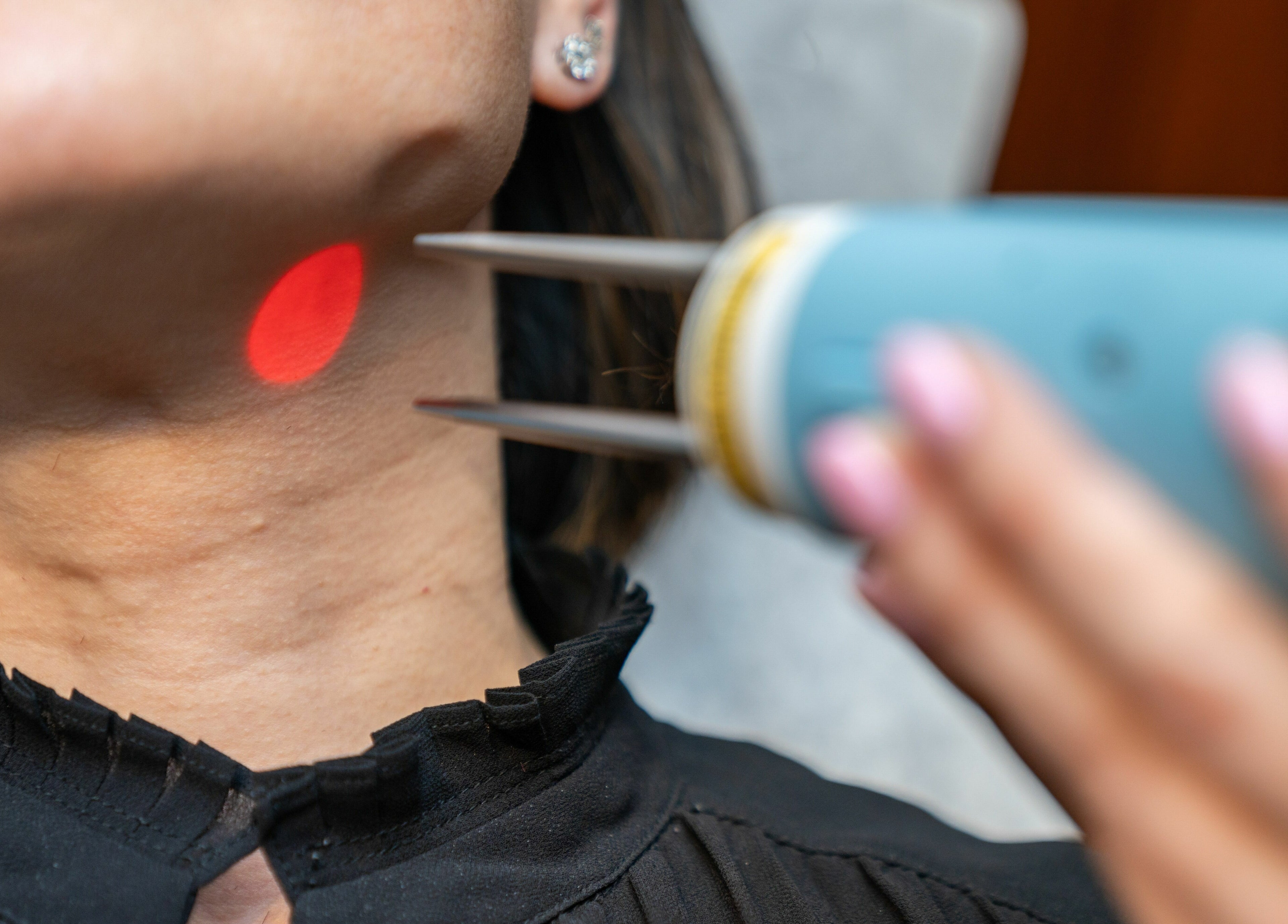 Professional laser treatment at W Laser Inc, New York, US, highlighting precision and care.