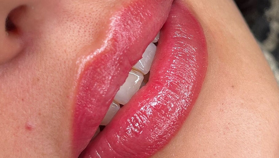 Dermoaethetic image 1