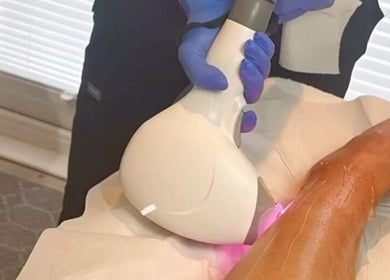 Laser treatment in progress at Laser & Beauty By Gemma, Chorley, England, GB, showcasing professional care.