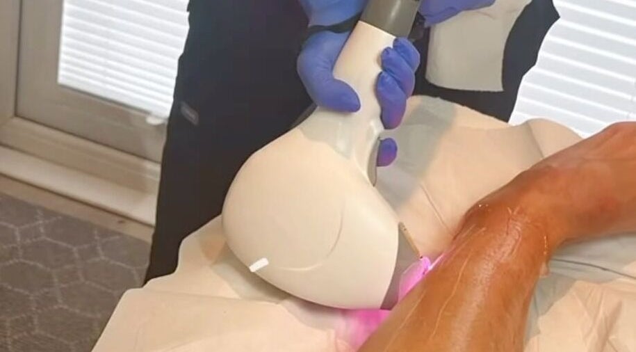 Laser treatment in progress at Laser & Beauty By Gemma, Chorley, England, GB, showcasing professional care.