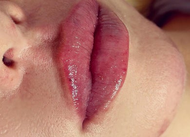 Close-up of glossy lips treated at Chelski-Aesthetics, London, England, GB showcasing vibrant lip care.
