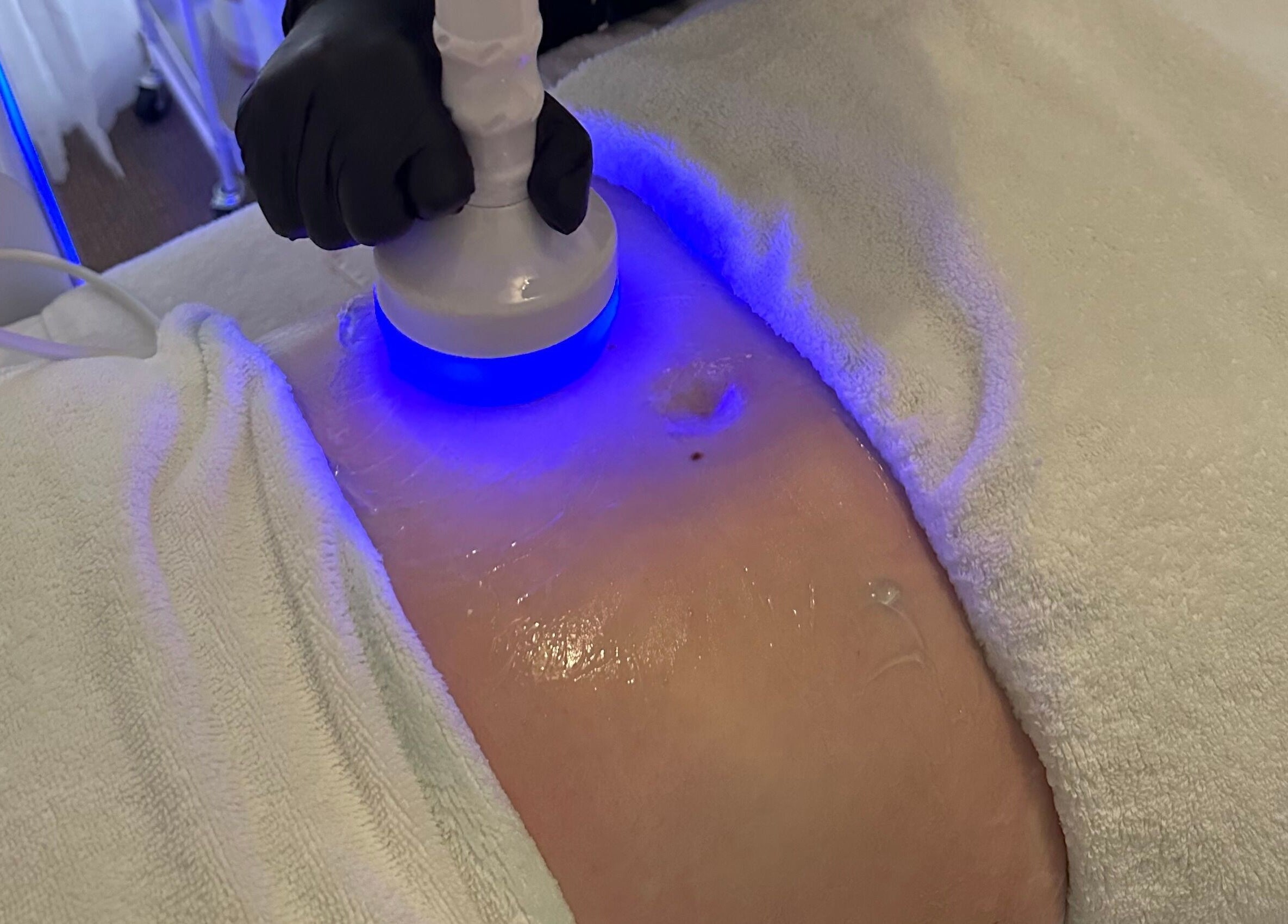 Body contouring treatment at Aphros Beauty, Homewood, Alabama, US, with glowing blue light.