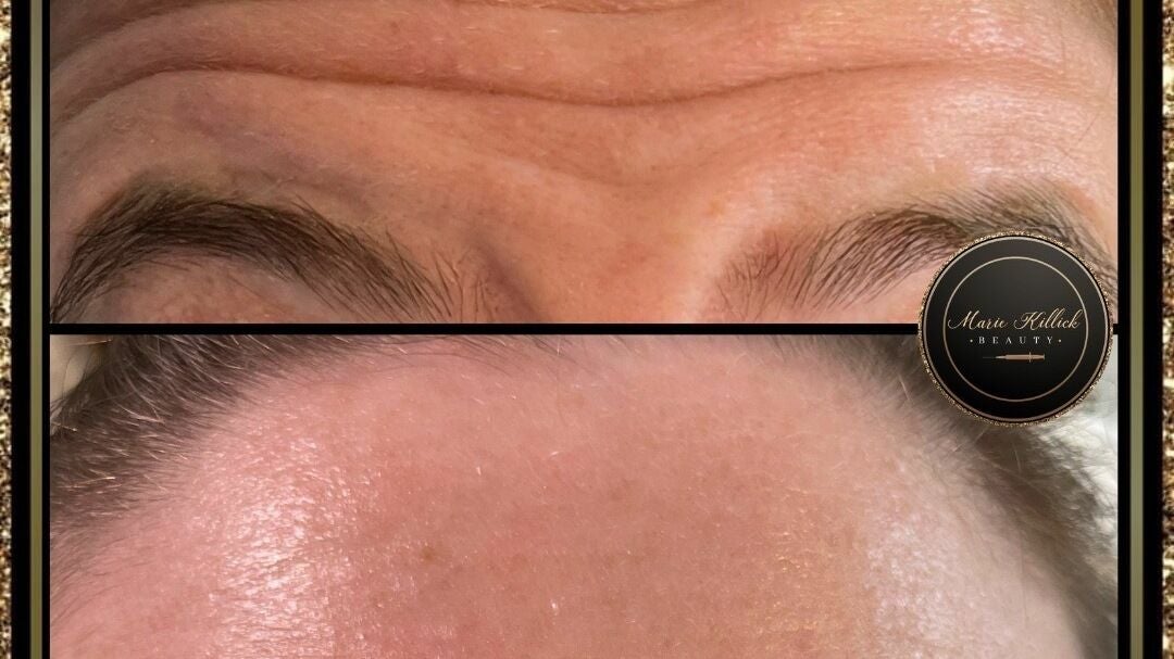 Permanent Makeup And Cosmetic Tattoo