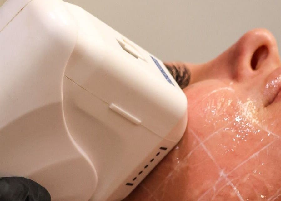 Facial skin treatment at AMORE BODY LAB, Applecross, Western Australia, AU using advanced equipment.