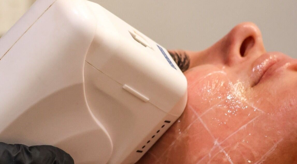 Facial skin treatment at AMORE BODY LAB, Applecross, Western Australia, AU using advanced equipment.