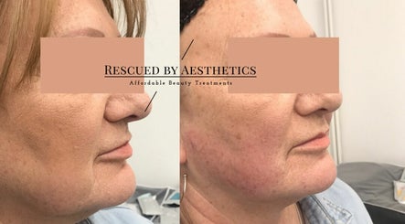Rescued by Aesthetics image 3