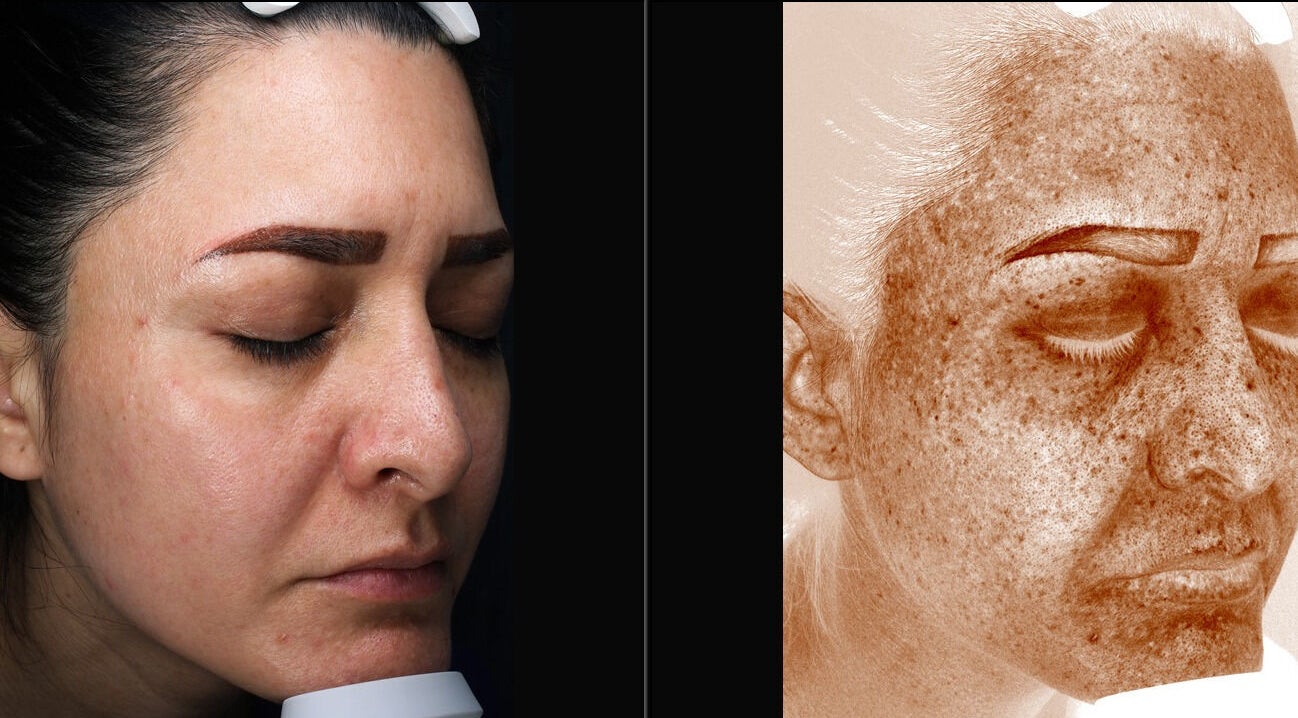 Análisis facial detallado en Biosense Clinica Laser - La Molina, La Molina, Provincia De Lima, PE.