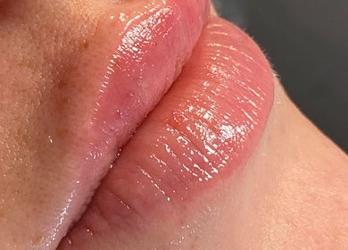 Close-up of glossy lips treatment at Lucy Nichols Beauty and Aesthetic, Norwich, England, GB