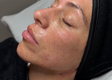Close-up of a glowing facial treatment at Lovetolashx, Rubery, England, GB, showcasing smooth skin.