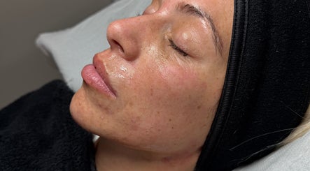 Relaxed face post-treatment at Lovetolashx, Rubery, England, GB, highlighting smooth, radiant skin.