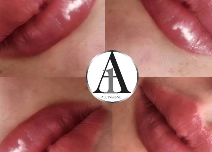 Collage of lush lips showcasing beauty at All In One Aesthetics, Droitwich Spa, England, GB.
