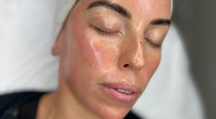 Close-up of refreshed skin after treatment at Remi Budd Beauty, Sturry, England, GB.