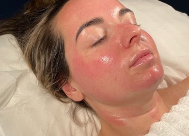 Relaxed woman receiving facial treatment at Emily Nagle Skin, Wallasey, England, GB, showcasing radiant skin care.