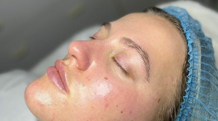 Emily Nagle Skin imagem 3