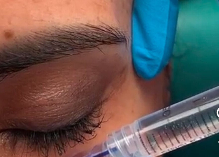 Tratamiento facial de precisión en ByBeauty, Sant Celoni, Catalunya, ES.