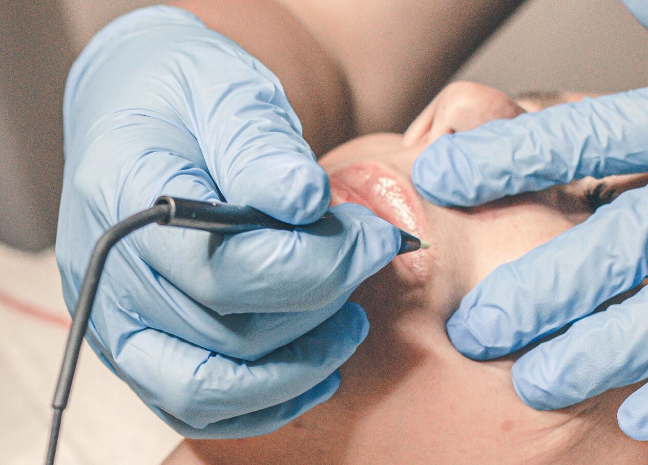 Lip treatment at Spa at the Madison, Burnaby, BC, CA with gloved hands performing precision skincare.