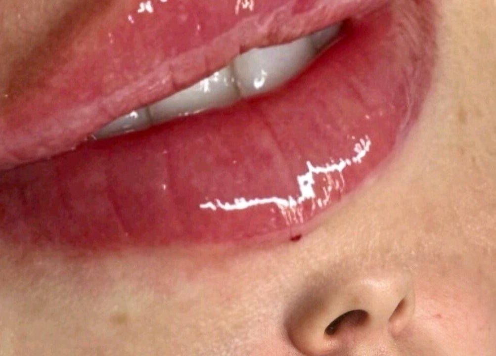 Glossy lips showcased at Tiptoe Beauty and Aesthetic‘s, Nuneaton, England, GB highlight luxury services.