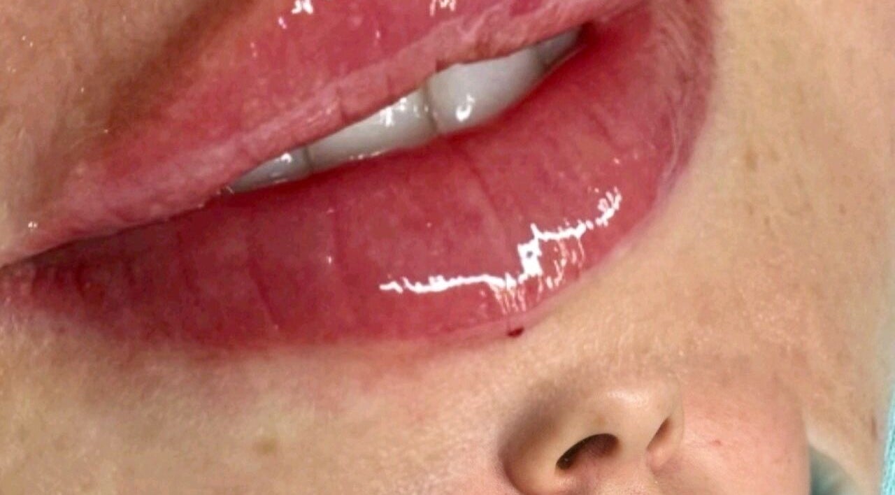 Glossy lips showcased at Tiptoe Beauty and Aesthetic‘s, Nuneaton, England, GB highlight luxury services.