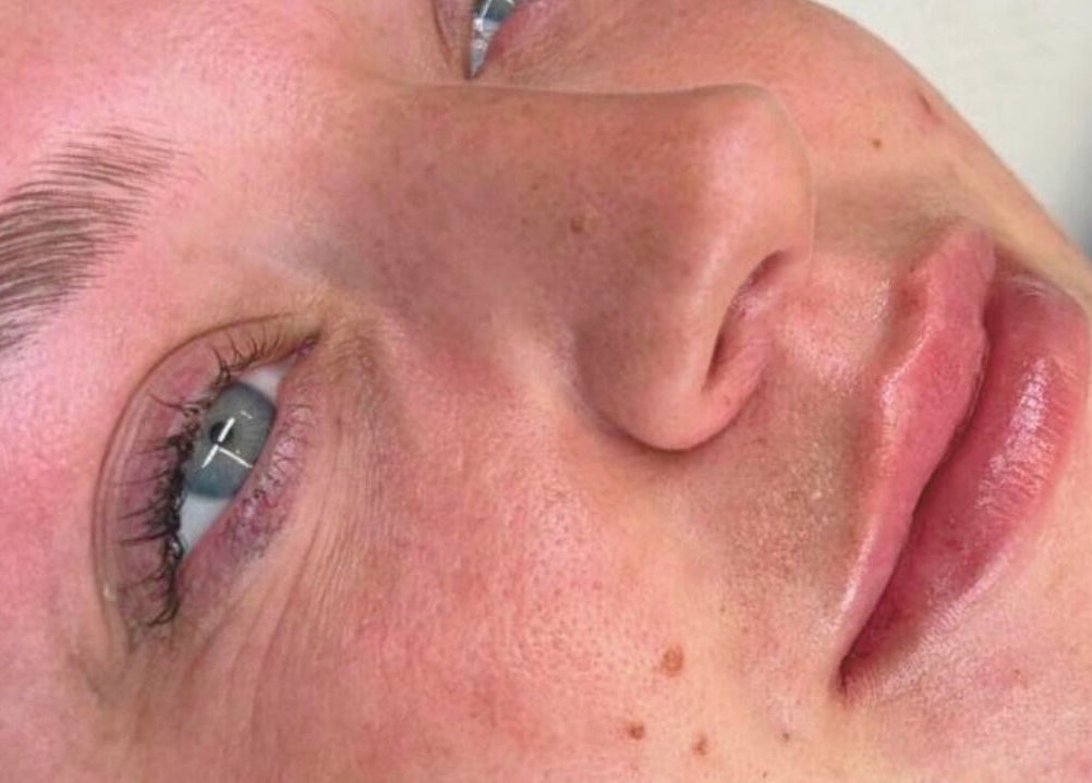 Close-up of a person's face showcasing smooth skin and brows at Tiptoe Beauty and Aesthetic's, Nuneaton, England, GB.