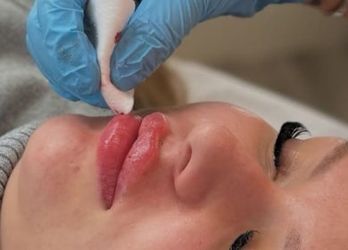 Expert lip treatment at Lous L.A.B, Tonbridge, England, GB. Enhancing beauty and wellness services.