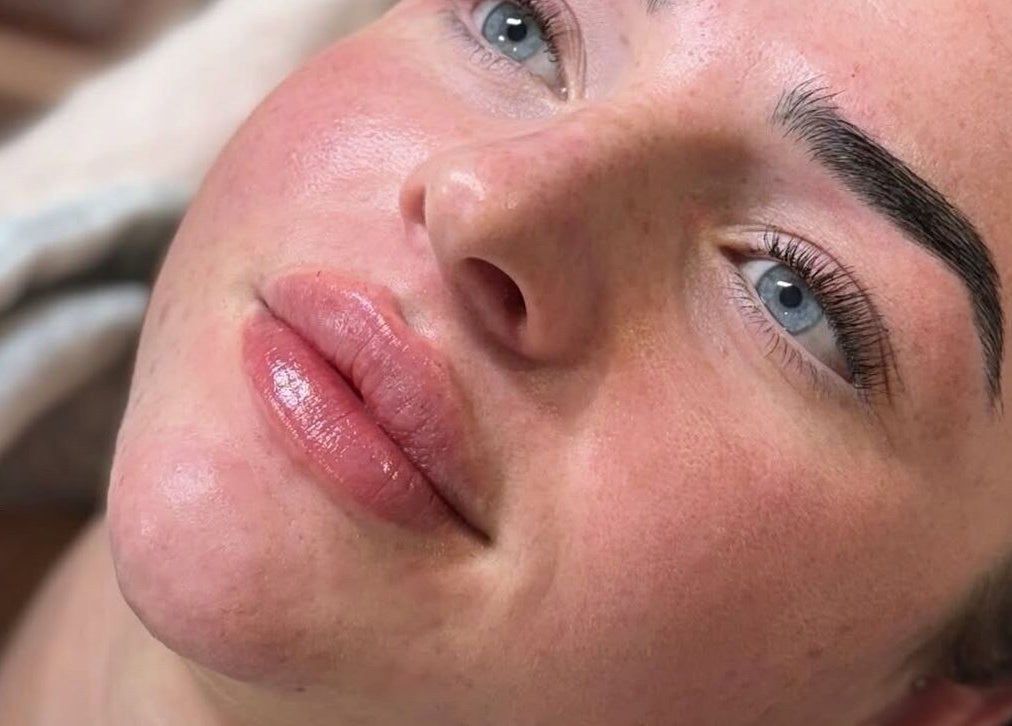 Close-up of a client's radiant face after a beauty treatment at Lous L.A.B, Tonbridge, England, GB.