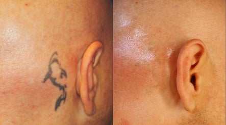 Ink Spot Tattoo and Laser Bild 3