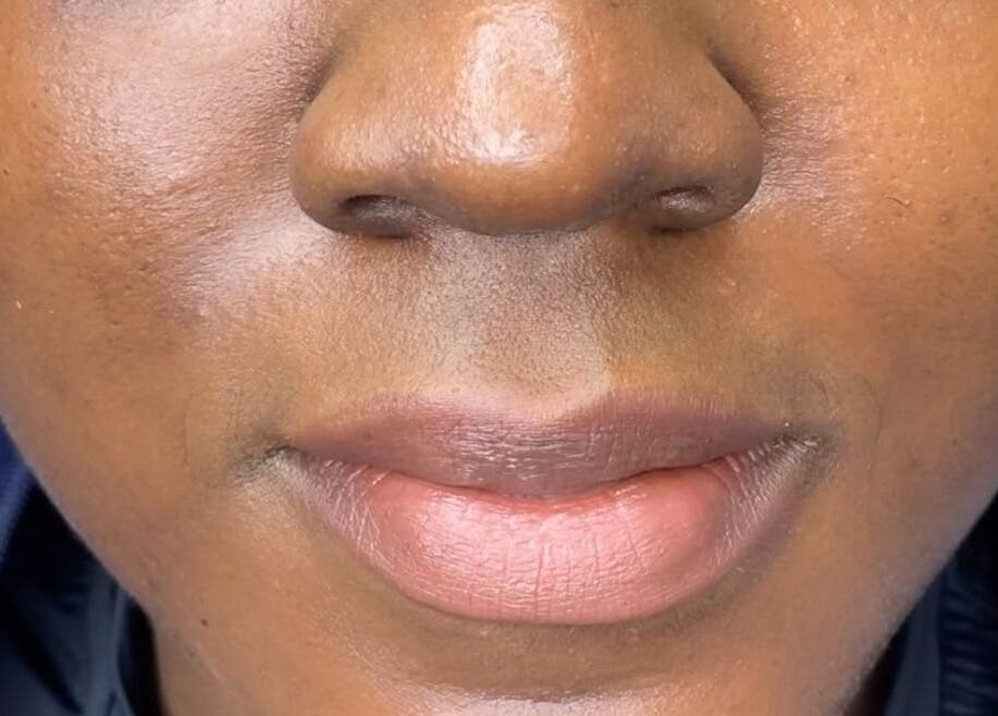 Close-up of smooth, radiant skin at Savoir Beauty Ltd, Point Fortin, TT, emphasizing beauty treatments.