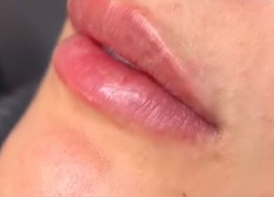 Close-up of well-nourished lips after treatment at Poise Studio, Rawmarsh, England, GB.
