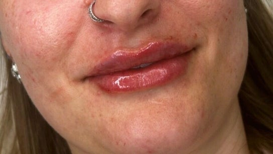 Wildbeautyspecialist Aesthetics