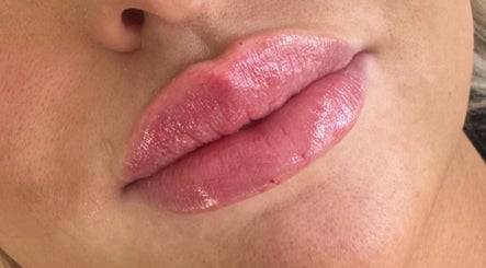 KB Skin and Aesthetics image 3