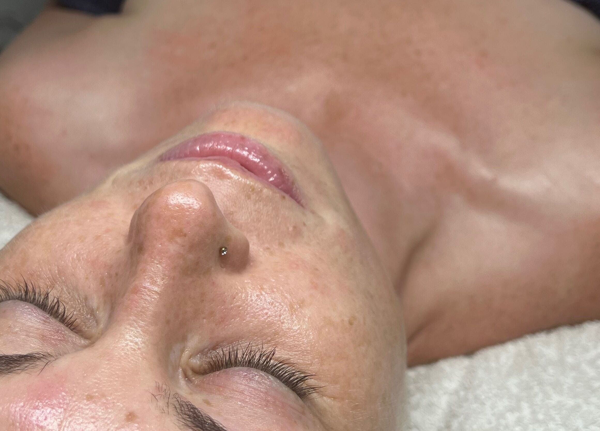 Client enjoying a soothing facial treatment at Beauty Lab, Drogheda, IE.