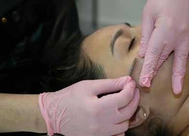 Facial treatment at Moon Wellness RMT, Vancouver, British Columbia, CA, enhancing skin with precision care.