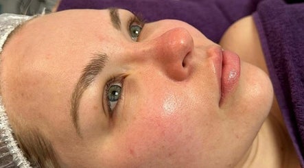 Facial Attraction image 3