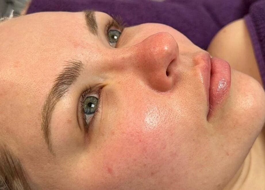 Close-up of a serene face during facial treatment at Facial Attraction, London, England, GB.