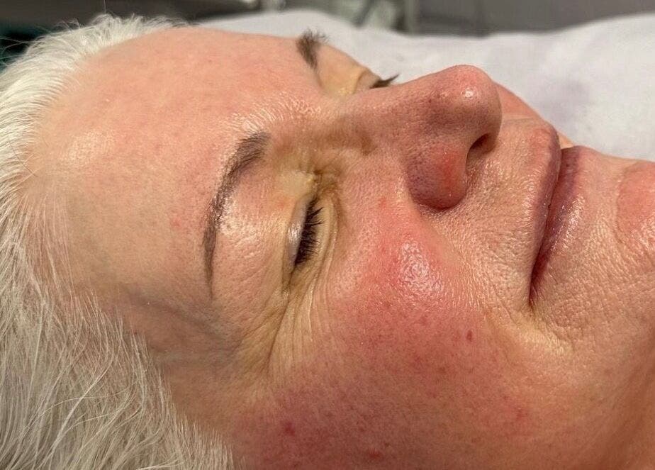 Close-up of a serene face during a facial treatment at Facial Attraction, London, England, GB.