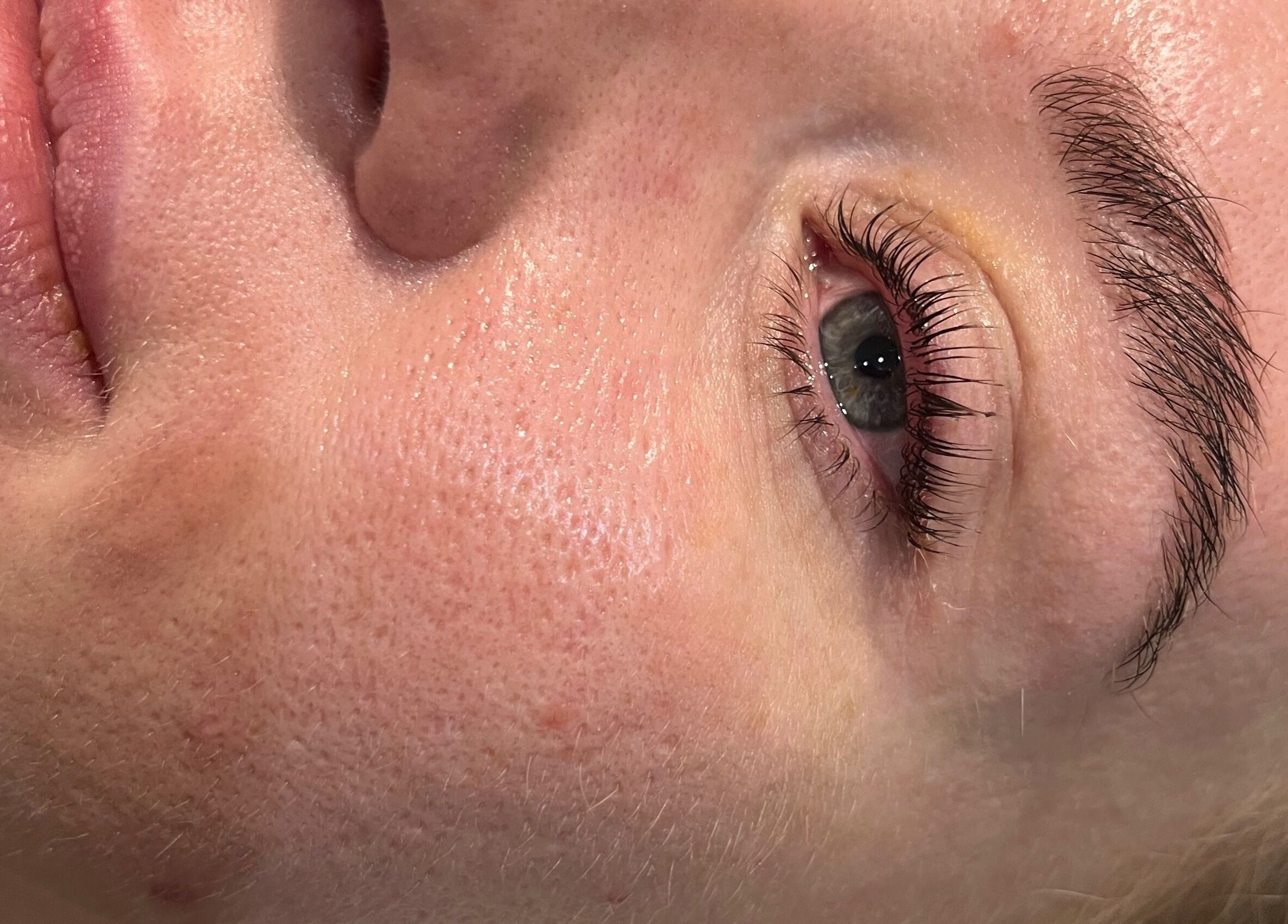 Close-up of a glowing skin treatment at Unique To You, Edinburgh, Scotland, GB, highlighting fresh results.