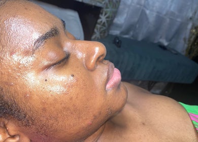 Facial treatment at Clinical Skin Care, Gasparillo, Couva-Tabaquite-Talparo Regional Corporation, TT.