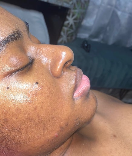 Facial treatment at Clinical Skin Care, Gasparillo, Couva-Tabaquite-Talparo Regional Corporation, TT.