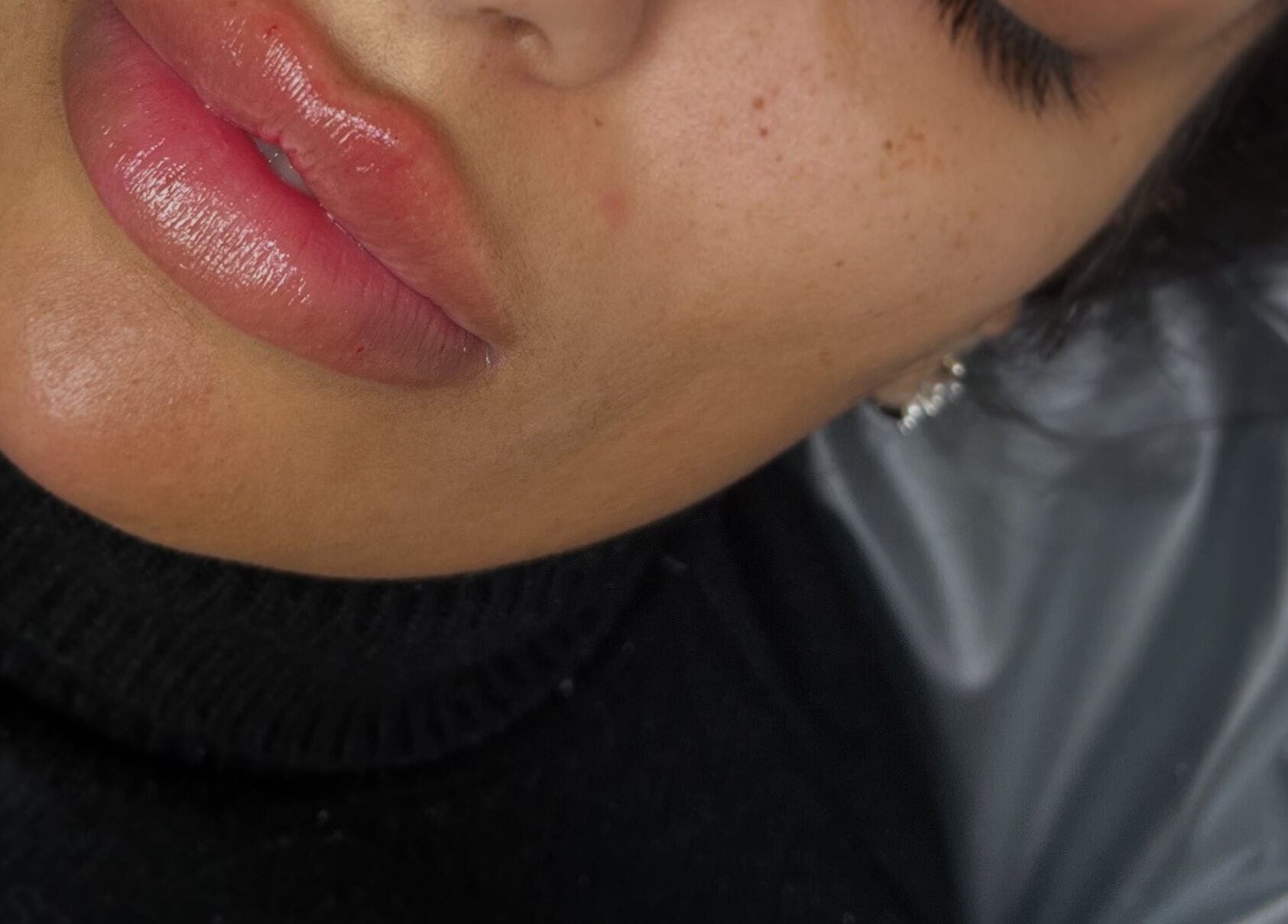 Close-up of smooth radiant lips at The Beauty Clinic, Bedford, England, GB.
