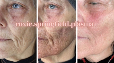 Roxie Springfield Skin & Plasma Specialist