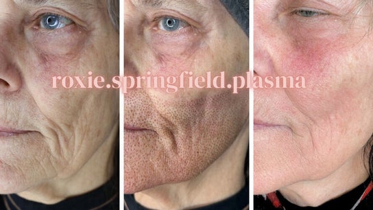 Roxie Springfield Skin & Plasma Specialist