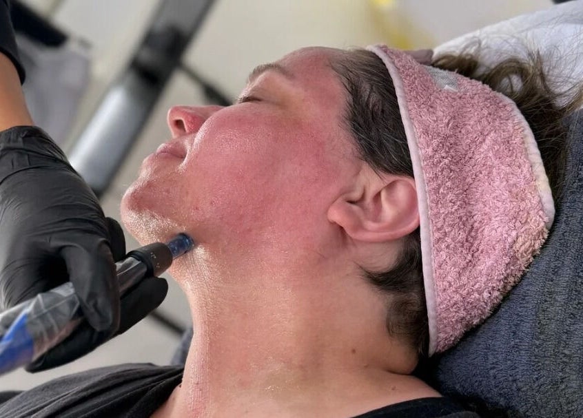 Facial treatment at Laser and Skin by Mabelle in Seven Hills, New South Wales, AU enhancing skin vitality.