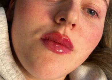Close-up of revitalized skin at Mediskin - Liverpool, located in Prescot, England, GB.