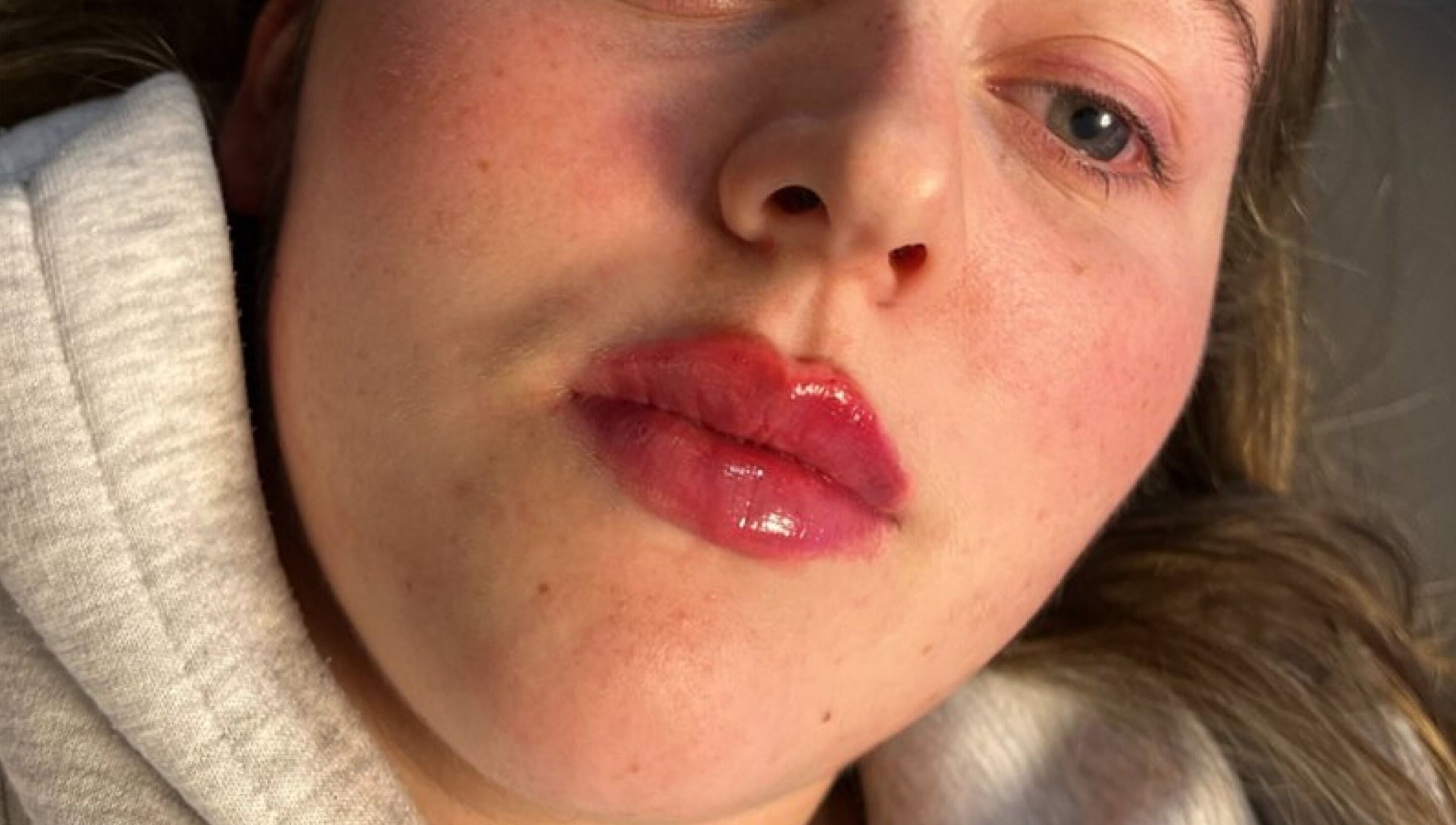 Close-up of a woman's radiant face at Mediskin - Liverpool, showcasing beauty results in Prescot, England, GB.