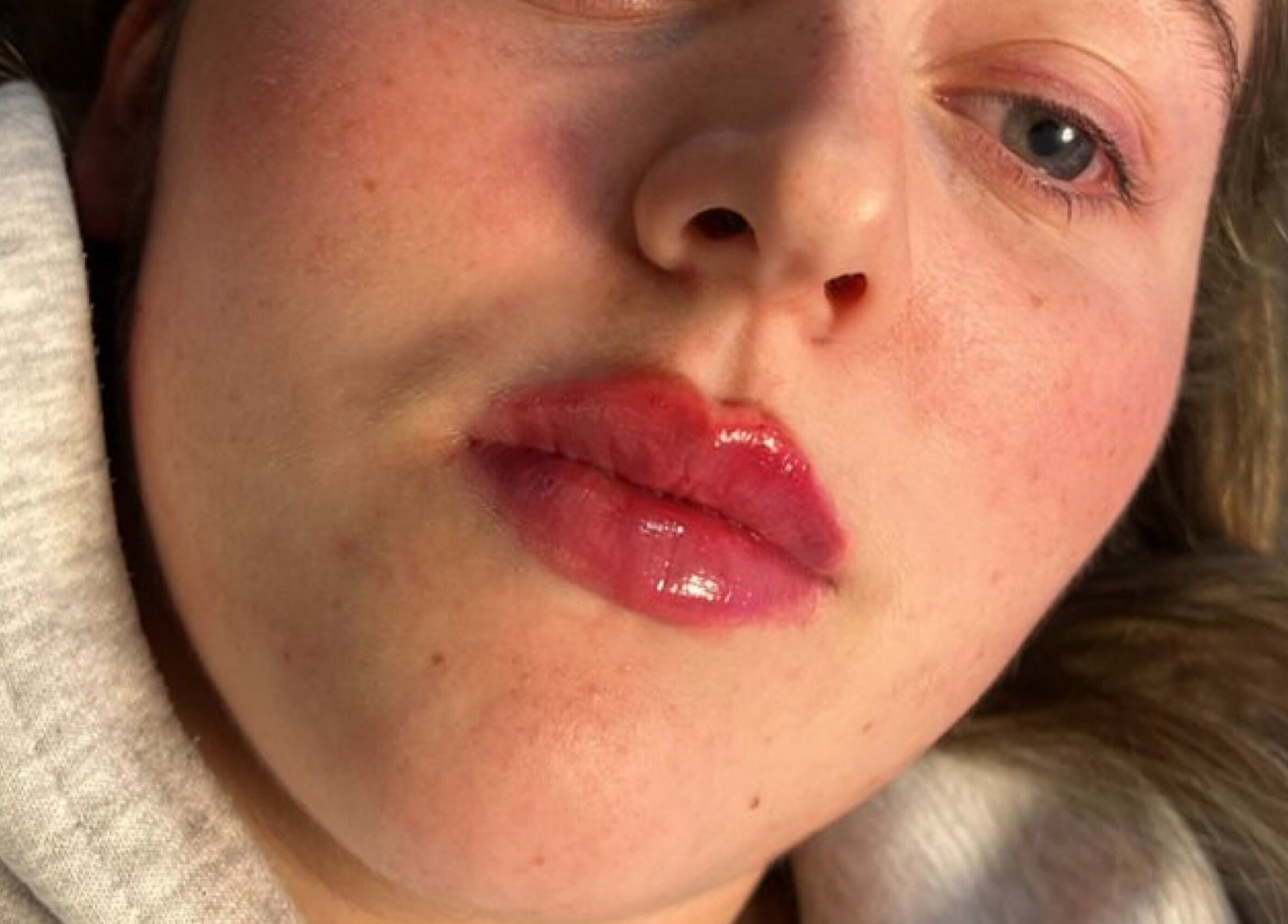 Close-up of a woman's radiant face at Mediskin - Liverpool, showcasing beauty results in Prescot, England, GB.