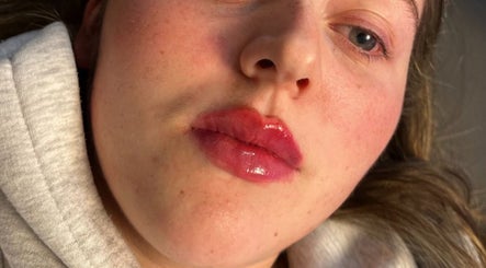 Close-up of a woman's radiant face at Mediskin - Liverpool, showcasing beauty results in Prescot, England, GB.