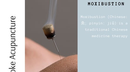 Moxibustion therapy at Bespoke Acupuncture Upper Street in London, England, GB. Traditional healing method.
