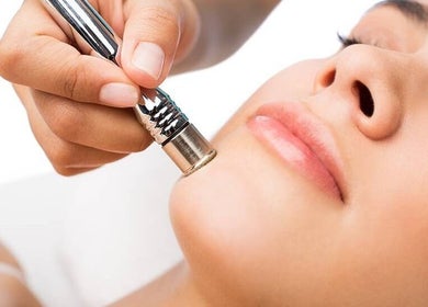 Microdermabrasion treatment at ND Skin Aesthetics, Leicester, England, GB. Enhancing smooth, rejuvenated skin.