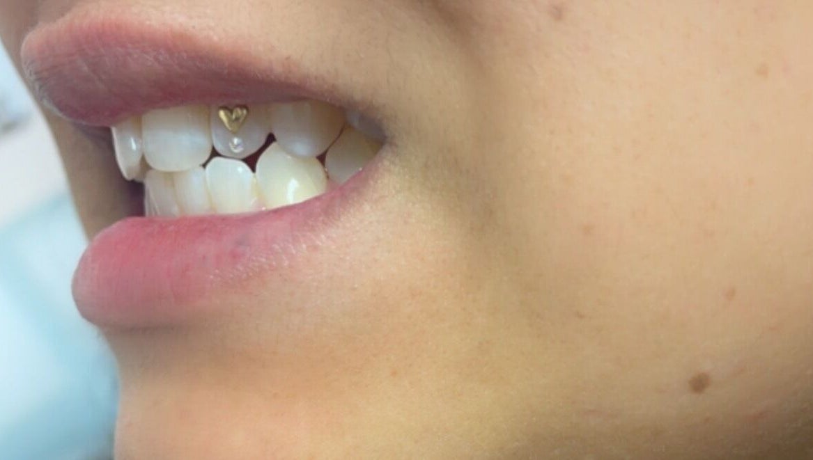 Close-up of a tooth gem design at Dazzling Beauty Lounge, Montgomery, Illinois, US.
