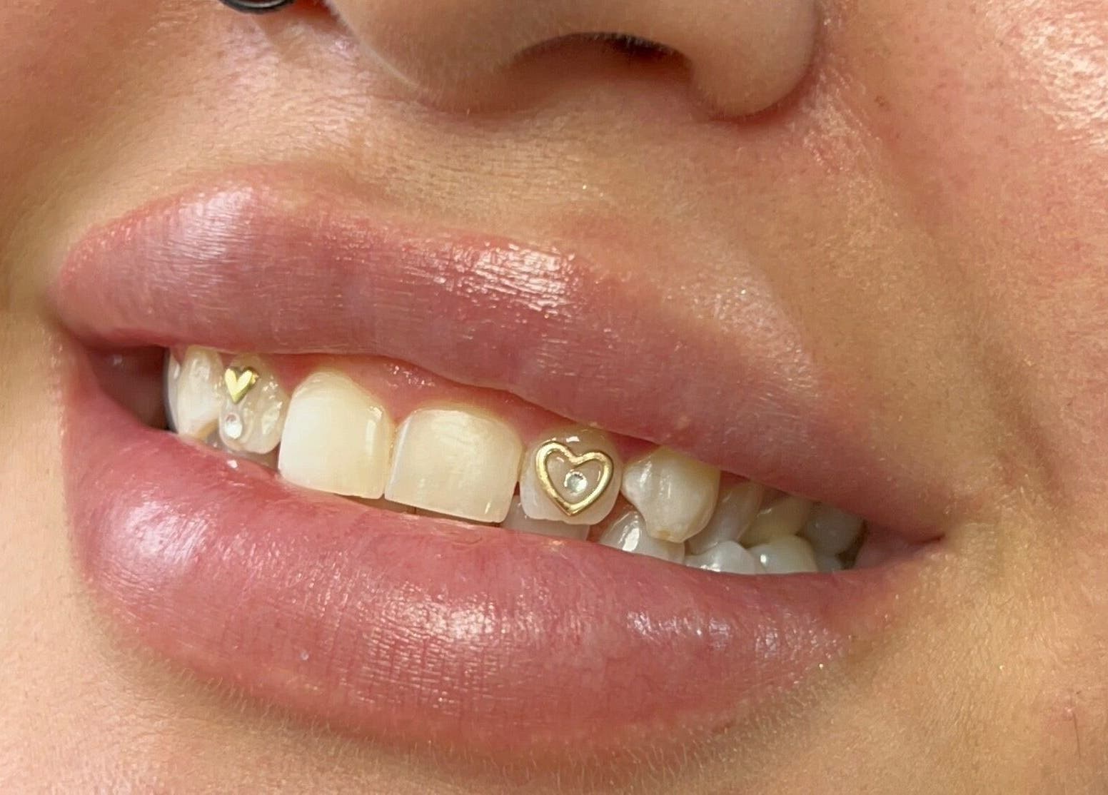 Gold tooth gems at Dazzling Beauty Lounge, Montgomery, Illinois, US. Perfect smile enhancement.